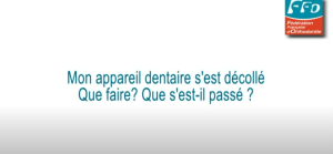 Bagues décollées